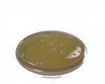 Sabouraud Dextrose Chloramphenicol Agar (SDCA) + Neutralizers -Contact plate        